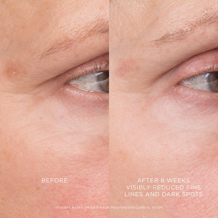 Equilibrium Resurfacing Retinoid Treatment